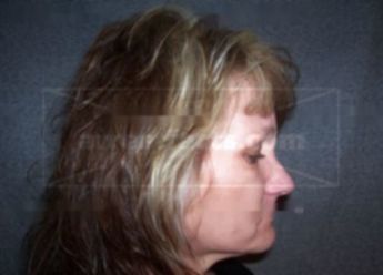 Darla J Wangerin