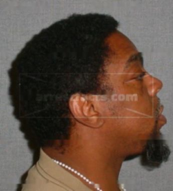 Rodney Anderson