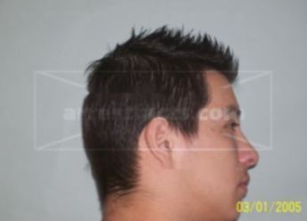 Martin A Perez