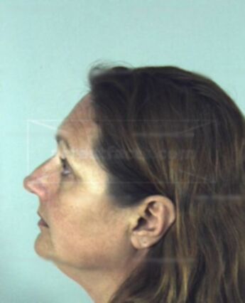 Kathy Ann Nugent