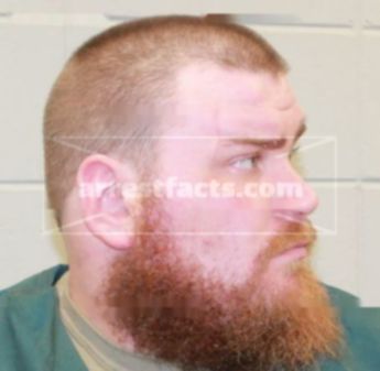 Brett J Myhre