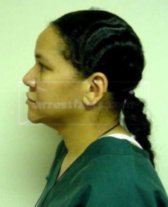 Carmen L Doss