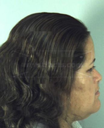 Azucena Angeles-Martinez