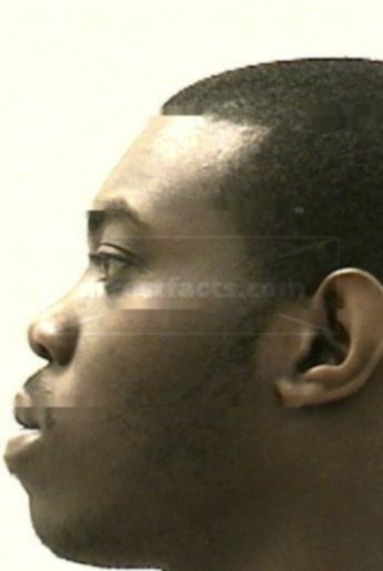 Jermichael Cordon Daniels