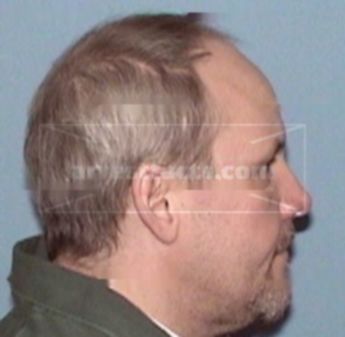 Jeffrey G. Lematty