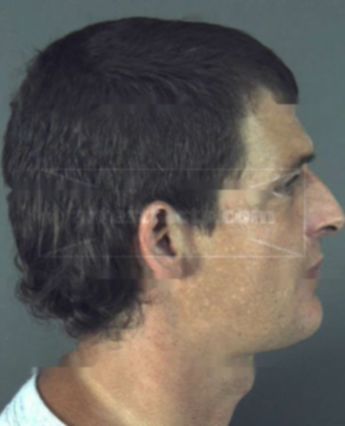 William Anthony Detten Jr