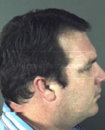 Gregory Stephen Mills