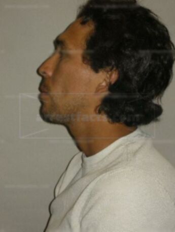 Alexander Gonzalez-Alvarado