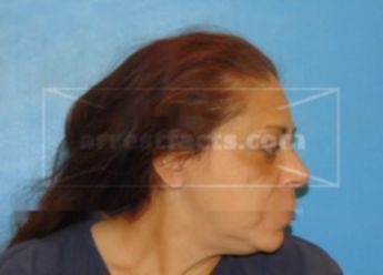 Sandra (Nmn) Castillo