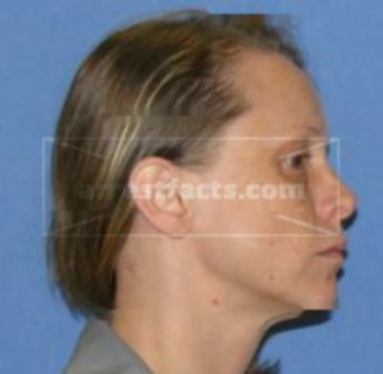 April Lynn Broyles