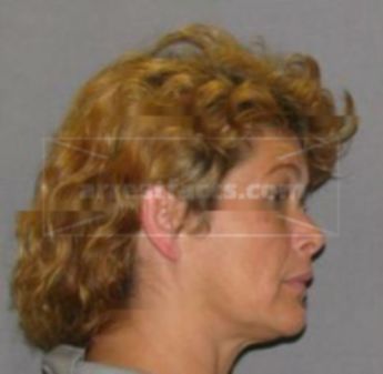 Ann Edgett