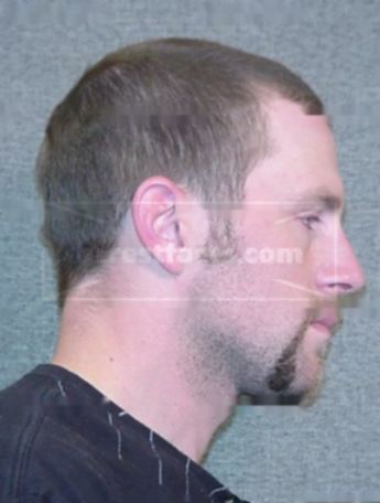 Justin G Larson