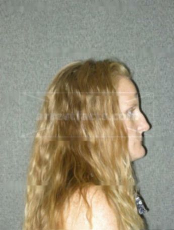 Debra L White