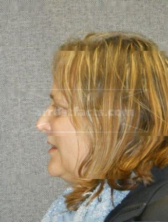 Linda J Turner