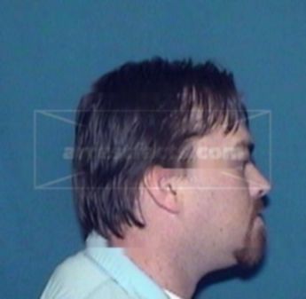 Alan D. Scroggins Ii