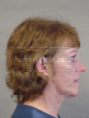 Peggy A Broadhead