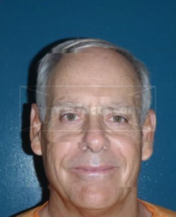 Howard R Bradley