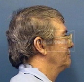 Dale D. Finch