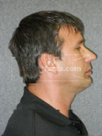 Ronald F Oehm