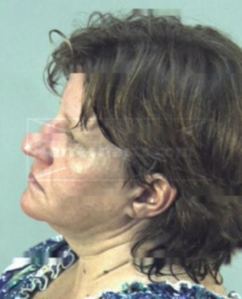 Lori Diane Palmer