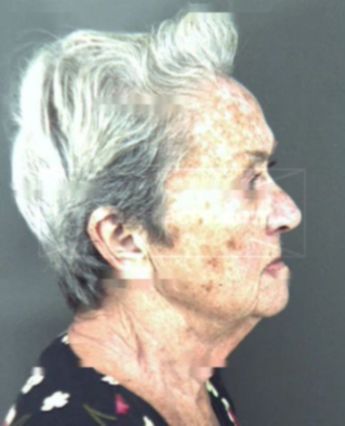 Dorothy L Erlandson
