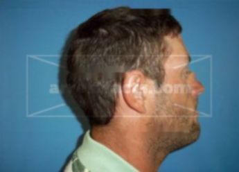 Matthew W Neal