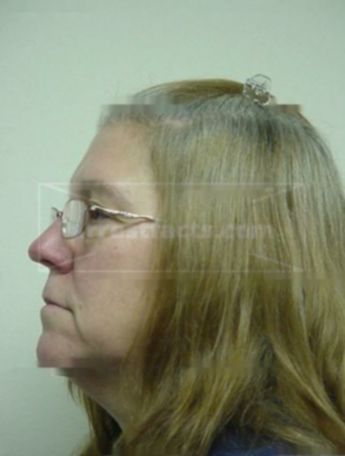 Deborah L Helms