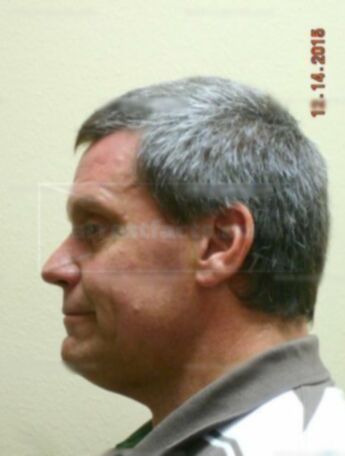 Eric L Philipsen