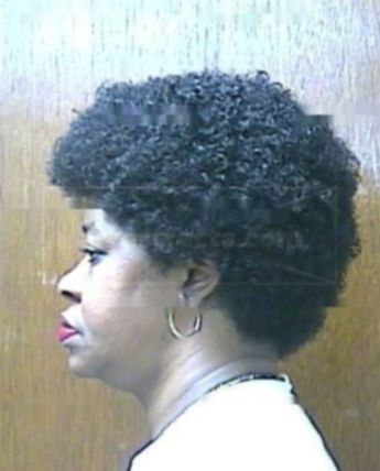 Janette L Adamson