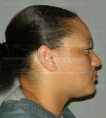 Kiesha D Barraud