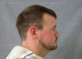 Matthew J Wulterkens