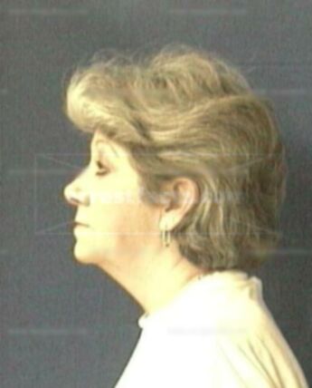 Donna L Coleman
