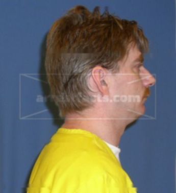 Robert S Bergmann