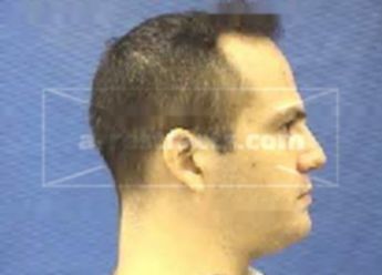 Todd Alexander Luna