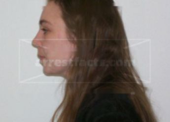 Elizabeth R Bergemann
