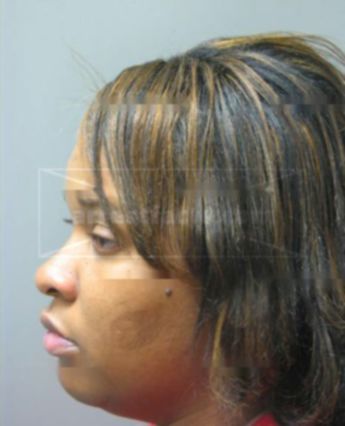 Katrice Burrell