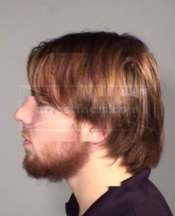 Jonathon Randal Burich