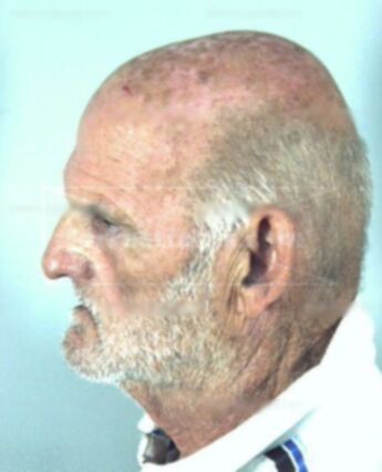 Thomas Gaetano Alberts