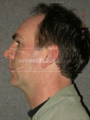 Allan D Dau