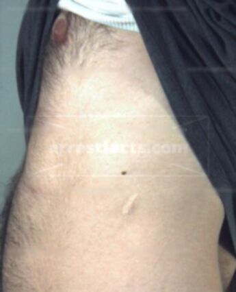 Anthony Arthur Bump