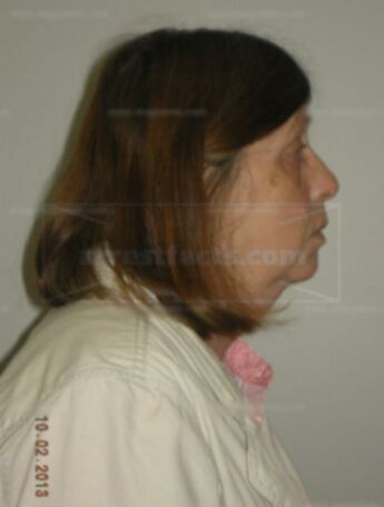 Patricia J Lopac