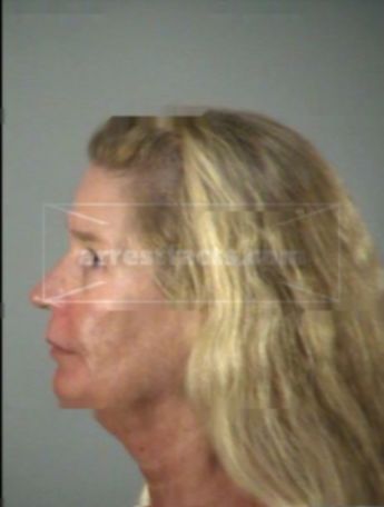 Cheryl Anderson Tiefert