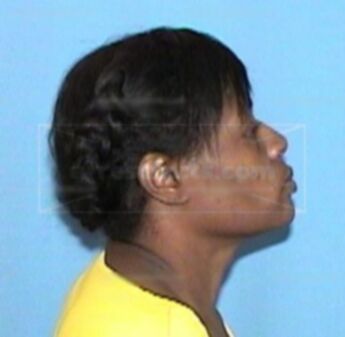 Adrianne Harold