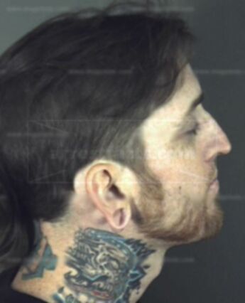 Ryan Mathew Boreske