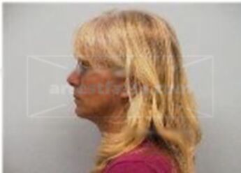 Linda Dahl Armstrong