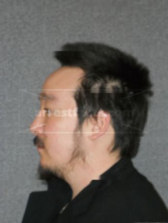 John L Kim