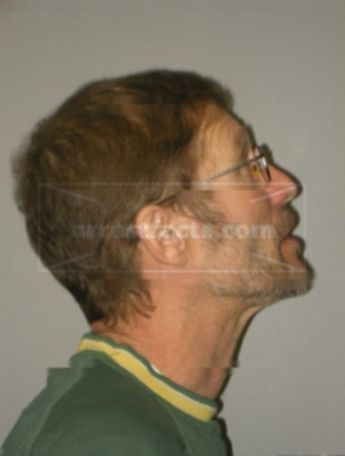John A Dentice