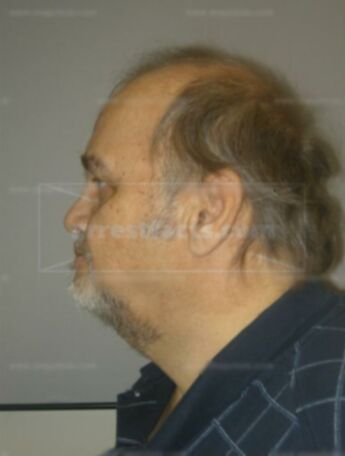 Robert J Christensen