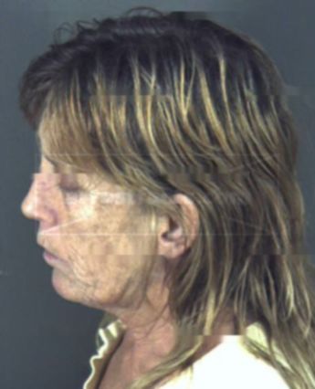 Wanda Lee Kowaleviocz