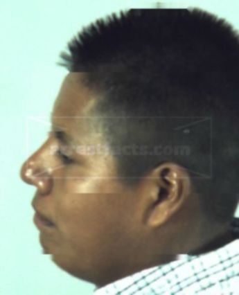 Isidro Mendez-Lopez
